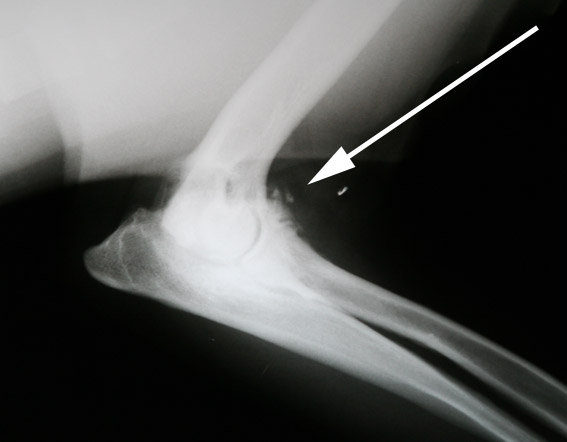 afbeelding Elleboogdysplasie (ED)