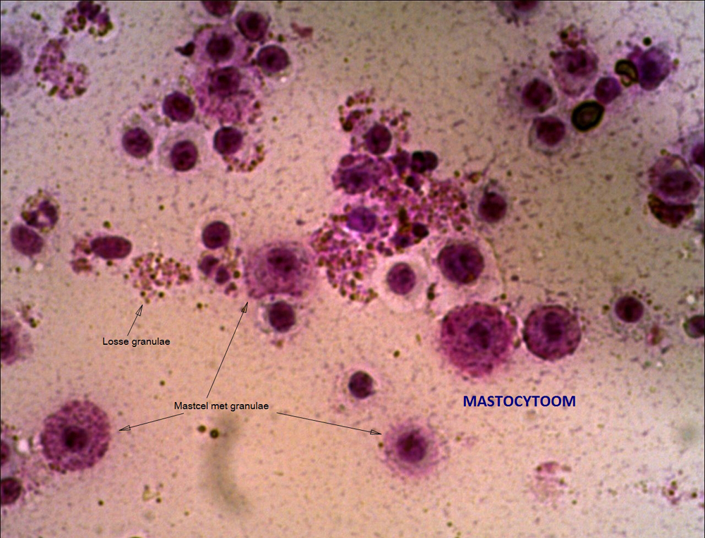 Een naaldbiopt na kleuring.