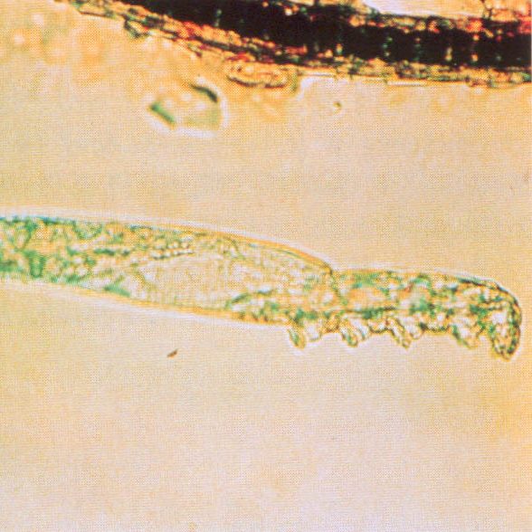 afbeelding Demodex bij de kat