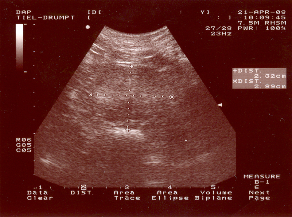 Dierenkliniek Tiel-Drumpt: Er kunnen verschillende prostaat problemen voorkomen. De echo is uitermate geschikt om een onderscheid te maken. Hier een echo beeld van een normale prostaat.