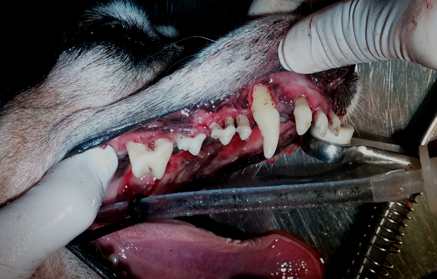 Na het verwijderen van het tandsteen en het vuil, blijken alle wortels bloot te liggen.