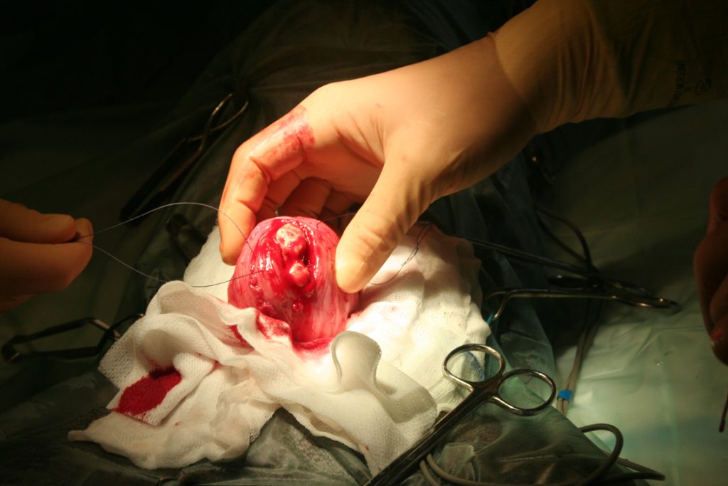 Het verwijderen van een blaassteen bij een hond