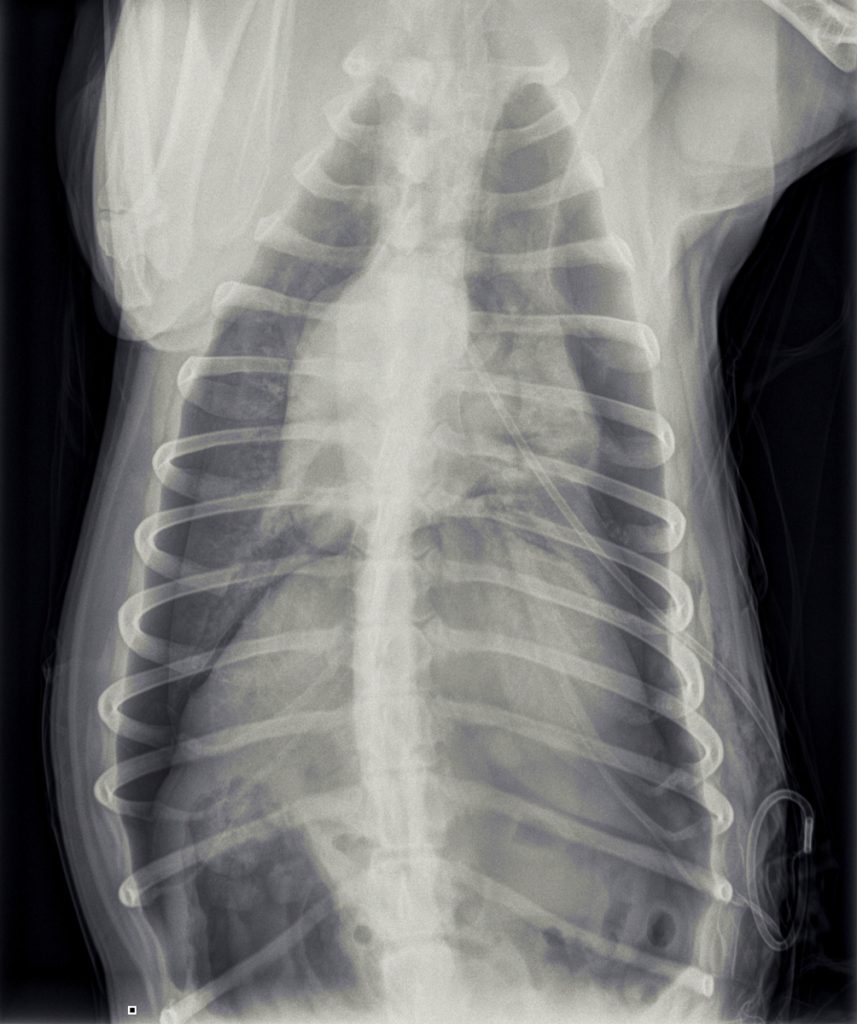 Op de röntgenfoto is de drain te zien.