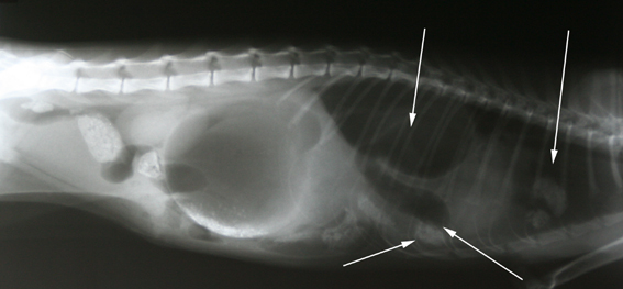 Bij de pijlen is te zien dat er buikinhoud naar de borstkast is verplaatst