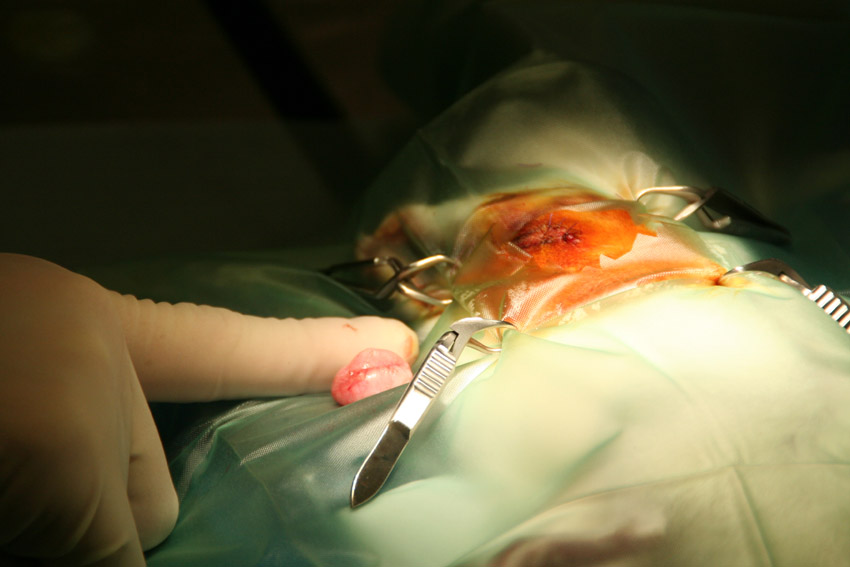 afbeelding Melkkliertumor