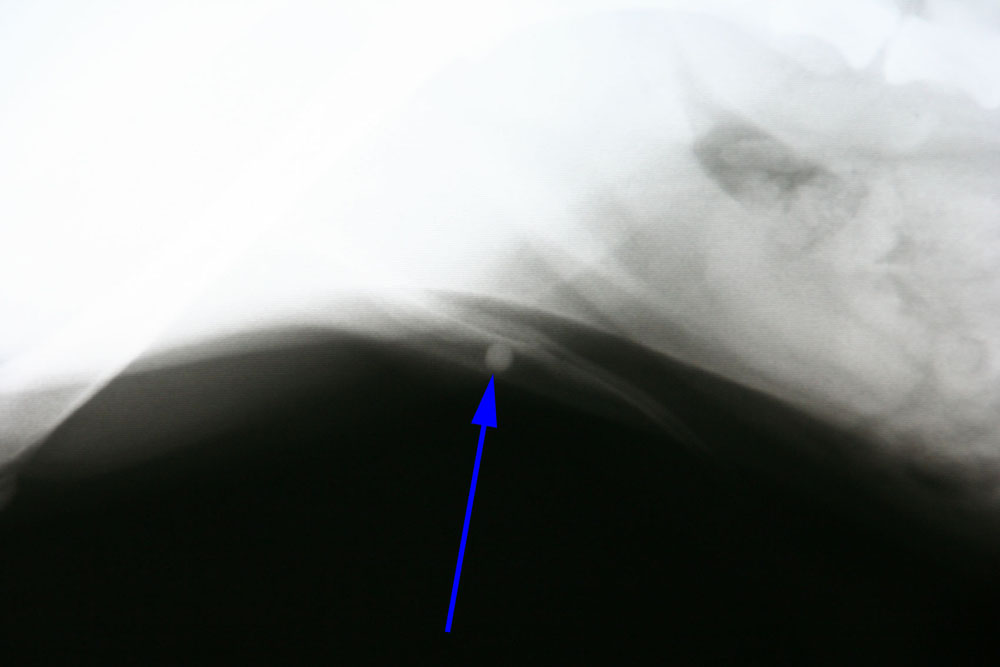 Bij de pijl ziet u het steentje goed zitten.