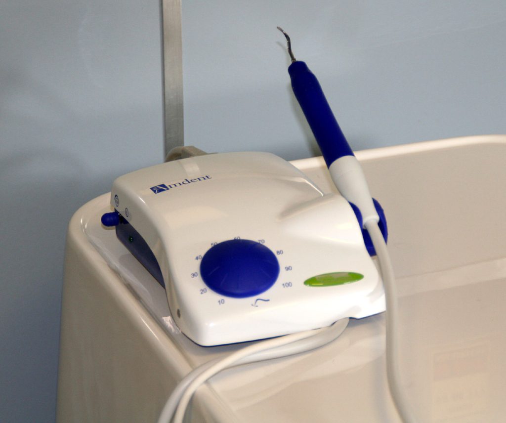 De ultrasoon wordt gebruikt om de kleine stukjes tandsteen te verwijderen.