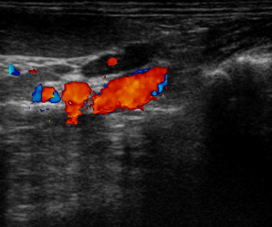 afbeelding Echografie