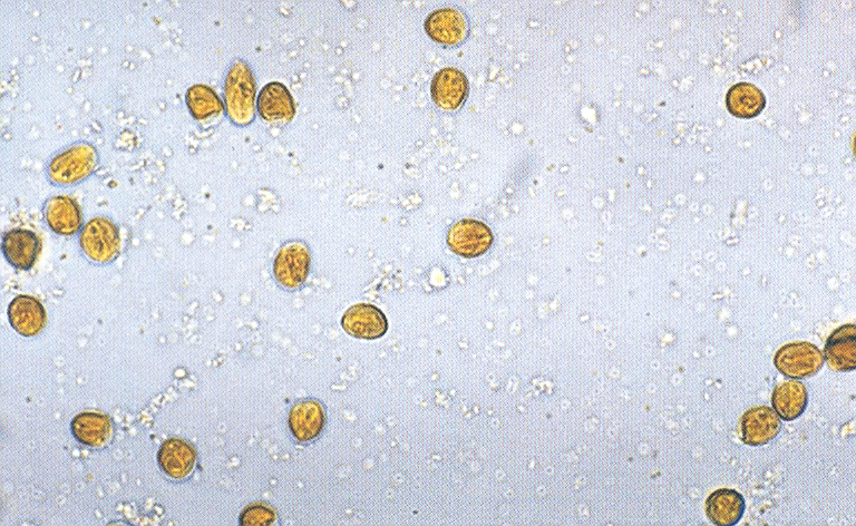 afbeelding Ontlastingsonderzoek