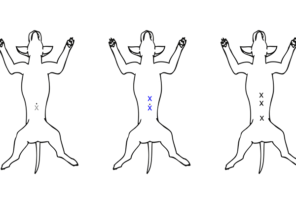 afbeelding Laparoscopisch steriliseren; welke methode?