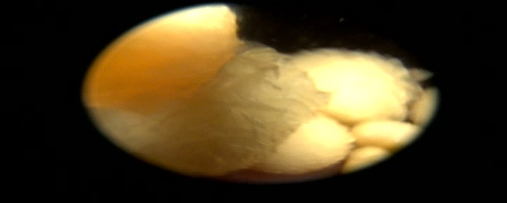 Dierenkliniek Tiel-Drumpt: Met de scoop is goed te zien dat er veel blaassteentjes aanwezig zijn bij het hondje.