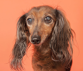 afbeelding Verhoogde oogboldruk (glaucoom)