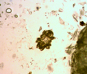 afbeelding Vachtmijt