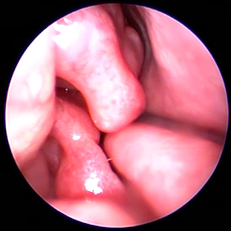 Dierenkliniek Tiel-Drumpt: Met behulp van de rhinoscopie (neusscopie) kan de dierenarts goed tussen de neusschelpjes door kijken.