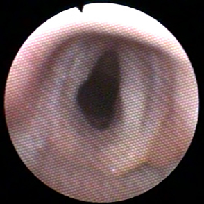 Dierenkliniek Tiel-Drumpt: Met behulp van een scoop kan de dierenarts tijdens een tracheobronchoscopie ook goed de stemspleet bekijken.