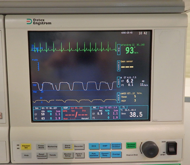 afbeelding Anesthesie (narcose)