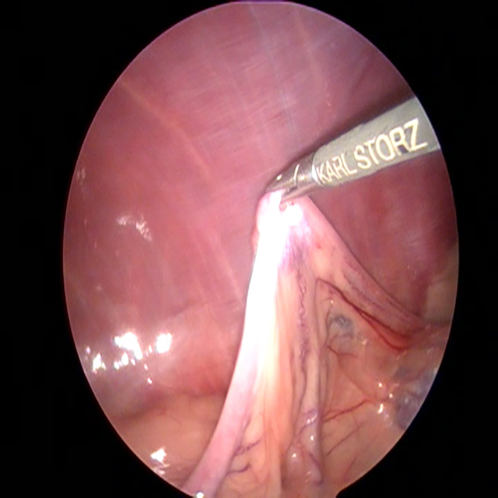 Dierenkliniek Tiel-Drumpt: Laparoscopische sterilisatie bij de hond: Soms moet je even zoeken voordat je de eierstok gevonden hebt.