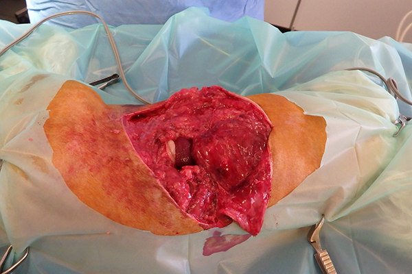 Dierenkliniek Tiel-Drumpt: De gebeten hond: De spierlaag is versnipperd en de vetlaag is moes.