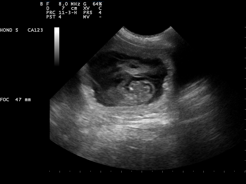 Dierenkliniek Tiel-Drumpt: Dierenarts voor Wamel: Met de dracht echo is te zien of de kittens of pups leven.