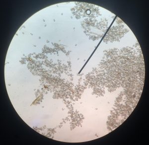 Dierenkliniek Tiel-Drumpt: Coccidiose bij het konijn, hier ziet u zeer veel coccidiën in de ontlasting.