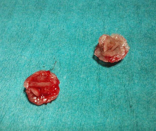 afbeelding Plaskater