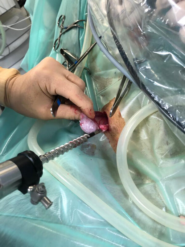 Dierenkliniek Tiel-Drumpt: Laparoscopisch geassisteerd opereren; de testikel wordt naar buiten gehaald.