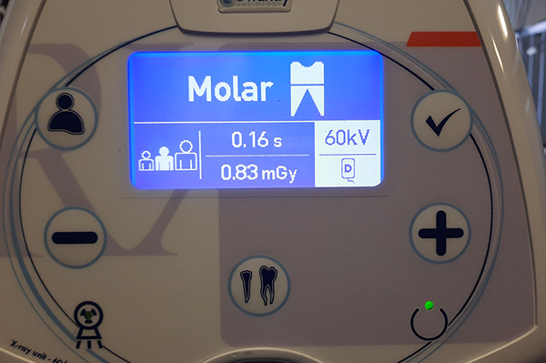 afbeelding Dentale röntgen, een verbetering van de gebitsbehandeling. 