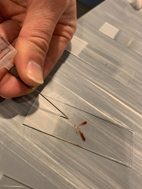 Dierenkliniek Tiel-Drumpt: Een naaldbiopt van een bult (DNAB), materiaal vanuit de naald