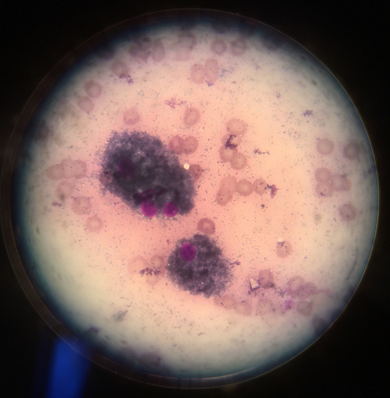 Dierenkliniek Tiel-Drumpt: Een naaldbiopt van een bult (DNAB), een gekleurd preparaat.