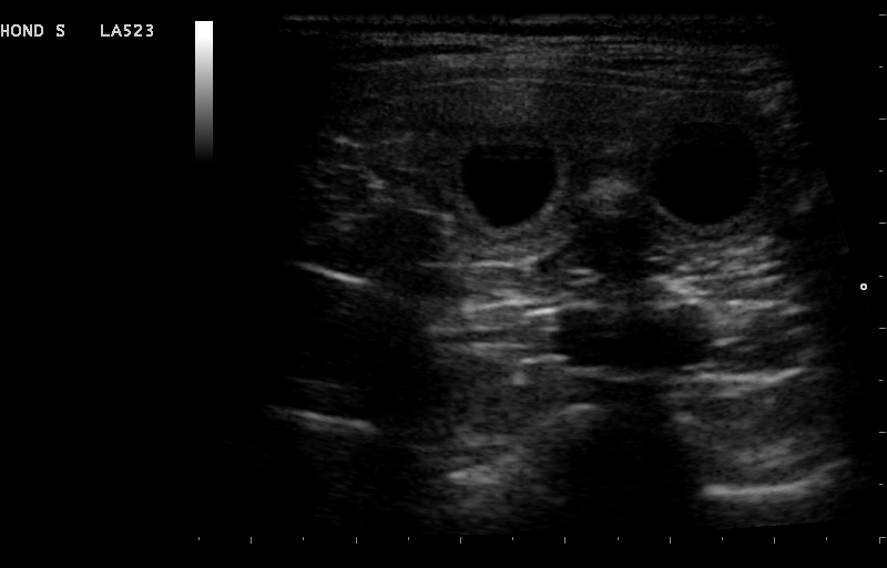Dierenkliniek Tiel-Drumpt: Drachtbegeleiding, de ampullen bij een beginnende dracht met de echo.
