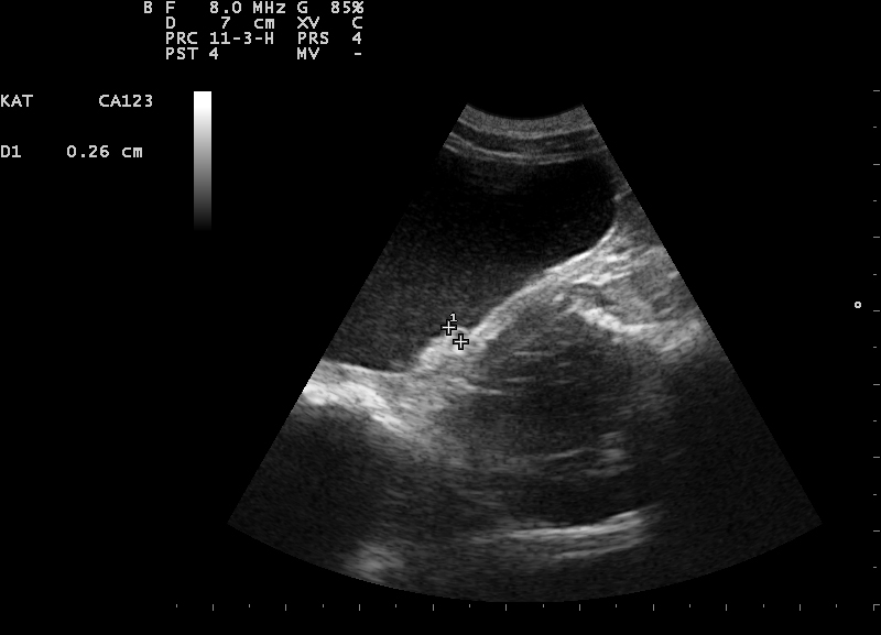 Dierenkliniek Tiel-Drumpt: Waarom plast mijn kat in huis? Blaasgruis en stenen