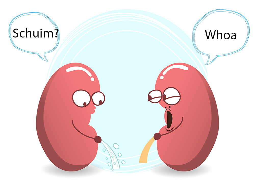 Dierenkliniek Tiel-Drumpt: Nierprobleem: eiwit in de urine kan een wat schuimend effect hebben in de urine.
