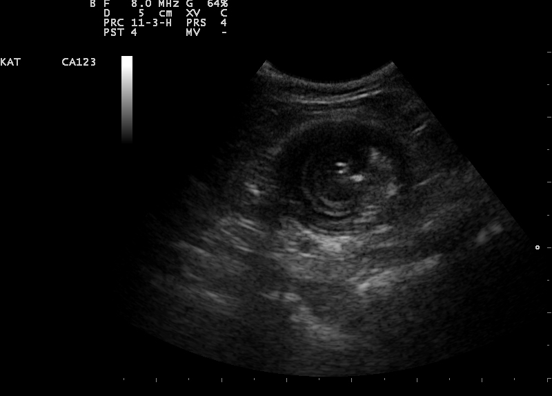 Dierenkliniek Tiel-Drumpt: Een darminvaginatie bij de kat