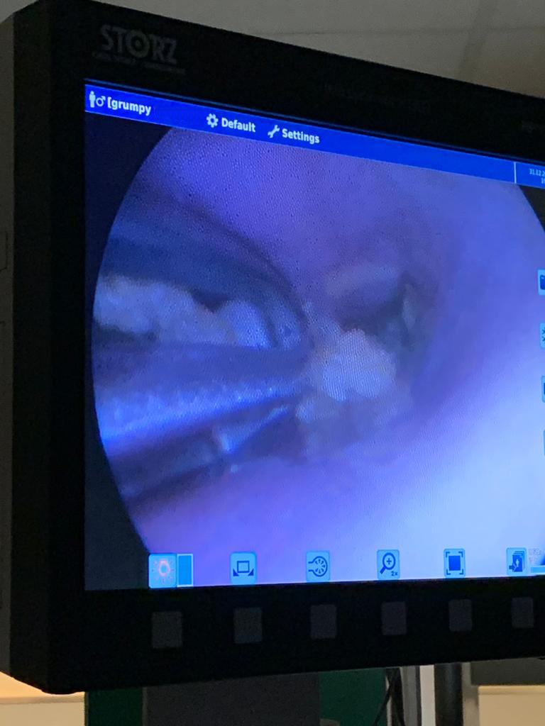 afbeelding Grumpy had wat in de slokdarm klem zitten