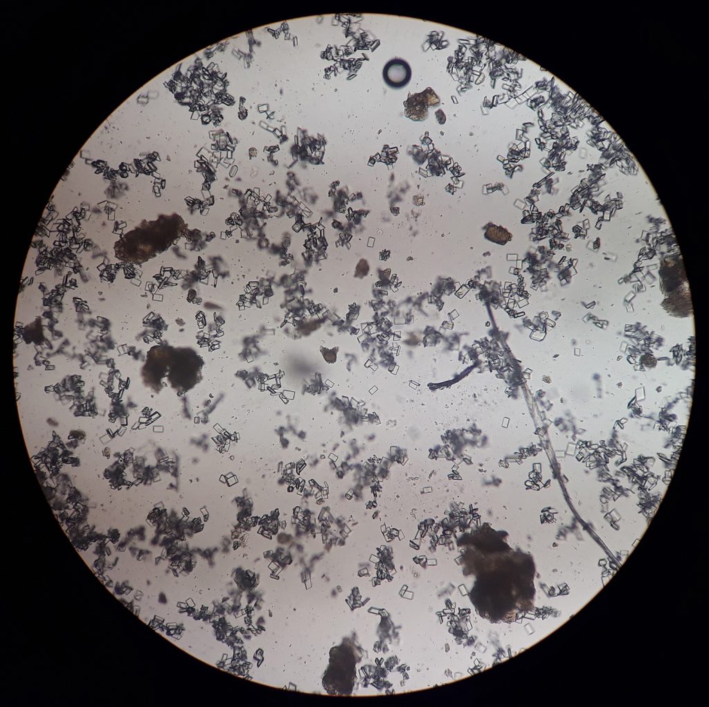 Dierenkliniek Tiel-Drumpt: urineonderzoek: sediment onder de microscoop: blaasgruis (struviet)