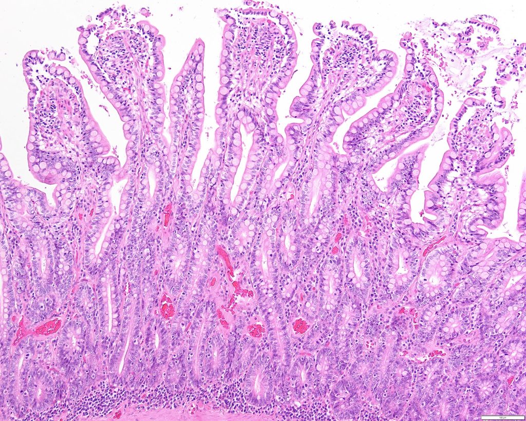 Dierenkliniek Tiel-Drumpt: Parvo: normale darm