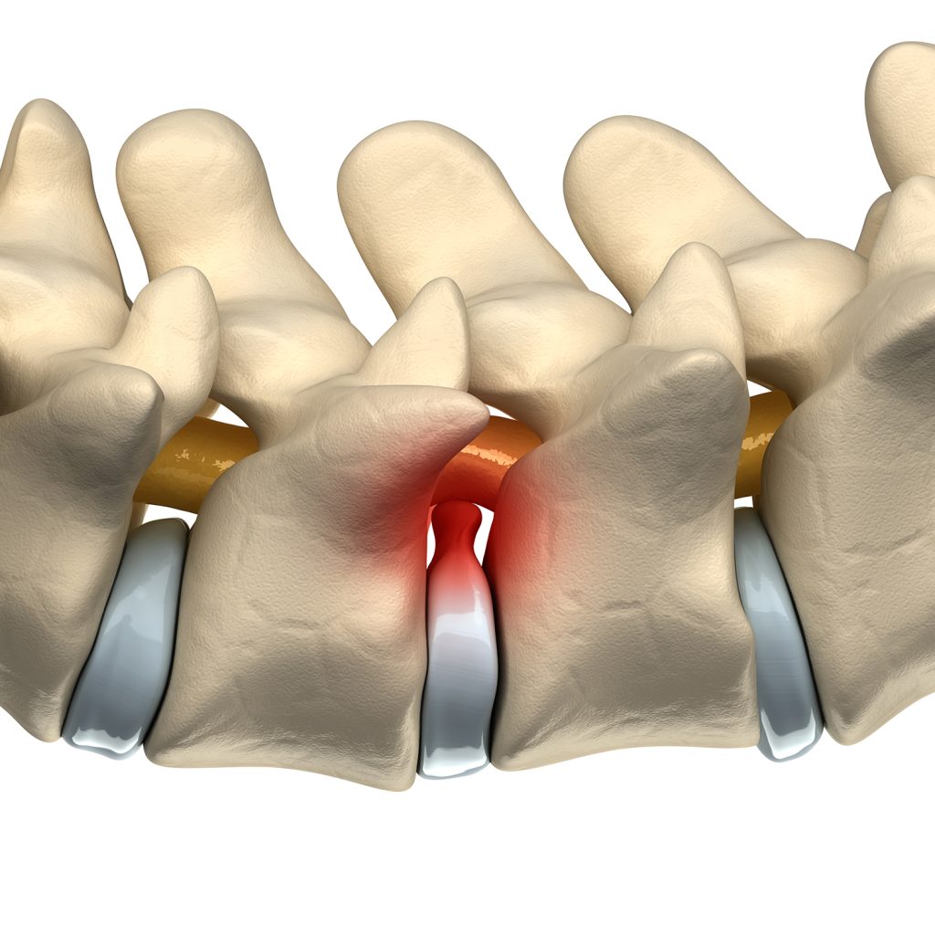 Dierenkliniek Tiel-Drumpt: Nekhernia en rughernia