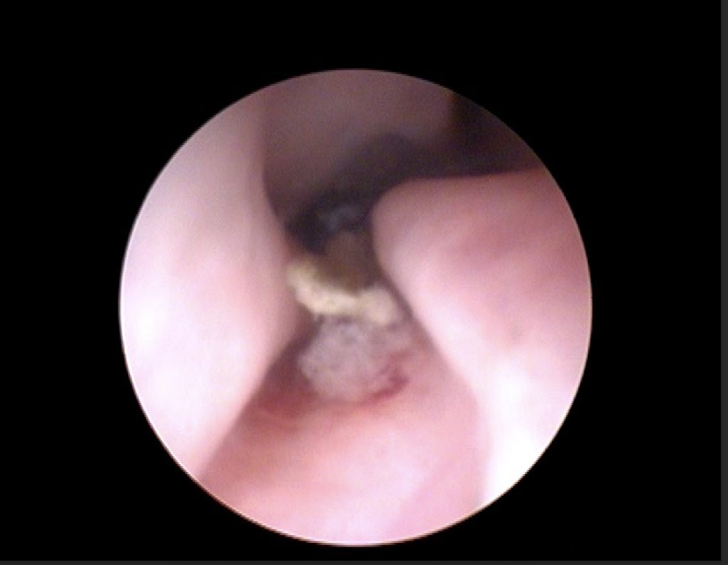 Dierenkliniek Tiel-Drumpt: Gras in de neusholte bij een hond.